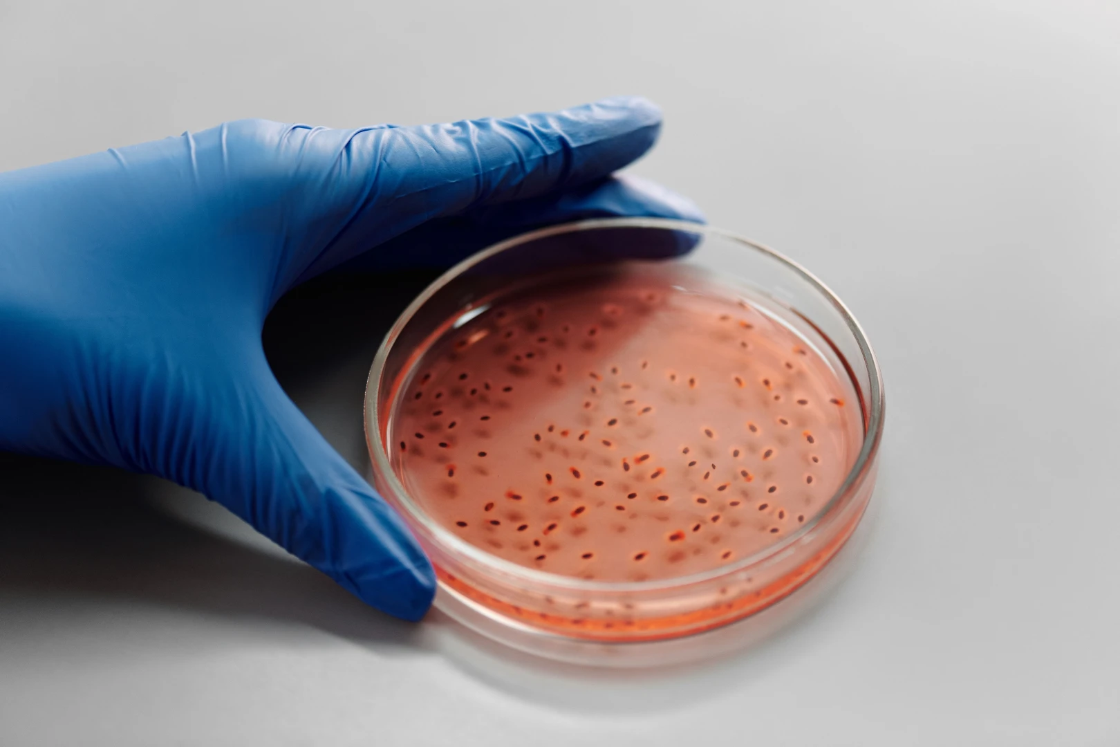 Bélmikrobiom vizsgálat – laboratóriumi DNS-szekvenálás