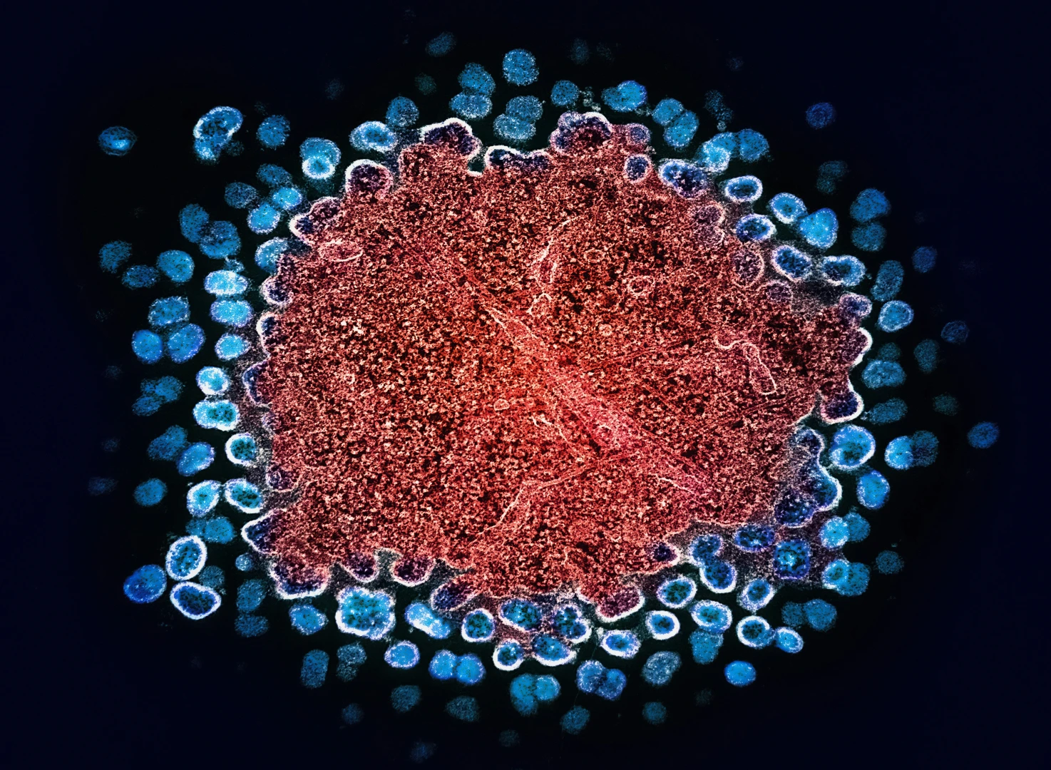 16S rRNA génszekvenálás és shotgun metagenomika összehasonlítása